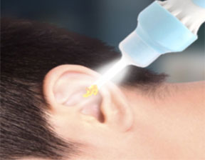 automatic ear remover